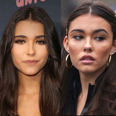 does madison beer have a boob job|Madison Beer Plastic Surgery: Quotes, Before, After。